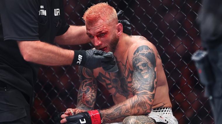 'Wake-up call' that saved UFC star's career