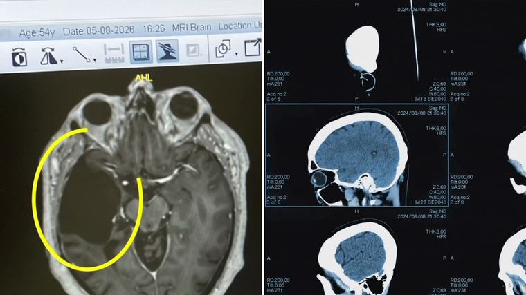 Australian scientists develop breakthrough treatment for deadly brain cancers