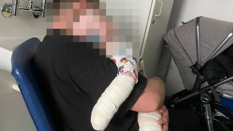 Aberdeen, UK: Little Dreams Nursery fined after 10 month old burnt by bleach, boiling water in 2021